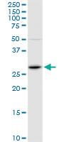 Anti-FOSL1 Rabbit Polyclonal Antibody