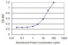 Anti-DMC1 Mouse Monoclonal Antibody [clone: 4A10]