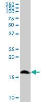 Anti-POLR1D Mouse Polyclonal Antibody