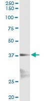 Anti-NKX2-5 Antibody Pair