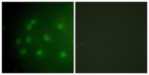 Immunofluorescence analysis of COS7 cells using Anti-Retinoblastoma (phospho Thr826) Antibody The right hand panel represents a negative control, where the antibody was pre-incubated with the immunising peptide