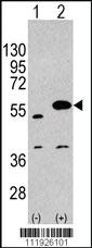 Anti-SPRED1 Rabbit Polyclonal Antibody