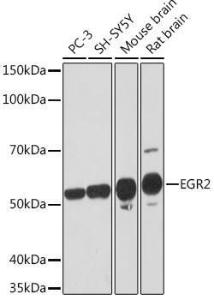 Western blot analysis of extracts of various cell lines, using Anti-EGR2 Antibody [ARC1932] (A307545) at 1:1,000 dilution. The secondary antibody was Goat Anti-Rabbit IgG H&L Antibody (HRP) at 1:10,000 dilution.