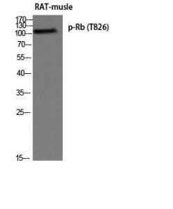 Western blot analysis of rat musle using Anti-Retinoblastoma (phospho Thr826) Antibody