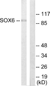 Western blot analysis of lysates from Jurkat cells using Anti-SOX6 Antibody. The right hand lane represents a negative control, where the antibody is blocked by the immunising peptide