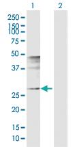 Anti-FOSL1 Rabbit Polyclonal Antibody