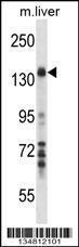 Anti-MAP3K1 Rabbit Polyclonal Antibody