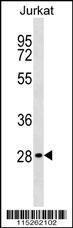 Anti-CABP1 Rabbit polyclonal antibody unconjugated