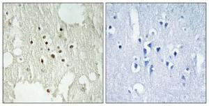 Immunohistochemical analysis of paraffin-embedded human brain using Anti-Retinoblastoma (phospho Thr826) Antibody 1:100 (4°C overnight) The right hand panel represents a negative control, where the antibody was pre-incubated with the immunising peptide