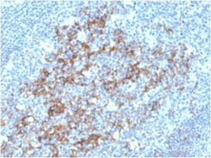 Immunohistochemical analysis of formalin-fixed, paraffin-embedded human tonsil using Anti-CD23 Antibody [FCER2/3592]