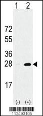 Anti-PSMA5 Rabbit Polyclonal Antibody