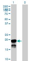 Anti-BRSK2 Mouse Polyclonal Antibody