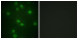 Immunofluorescence analysis of HUVEC cells using Anti-Retinoblastoma (phospho Ser811) Antibody. The right hand panel represents a negative control, where the antibody was pre-incubated with the immunising peptide