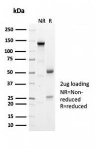 SDS-PAGE analysis of Anti-Geminin Antibody [GMNN/7037R] under non-reduced and reduced conditions; showing intact IgG and intact heavy and light chains, respectively SDS-PAGE analysis confirms the integrity and purity of the antibody