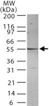 Anti-PSEN2 Mouse Monoclonal Antibody [clone: 198C679.2.]