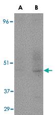 Anti-CD209 Mouse Monoclonal Antibody [clone: 5D7]