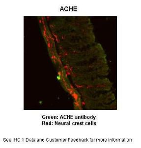 Anti-ACHE Rabbit Polyclonal Antibody