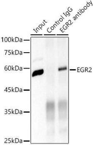 Immunoprecipitation analysis of 600µg extracts of mouse brain cells using 3µg of Anti-EGR2 Antibody [ARC1932] (A307545). This Western blot was performed on the immunoprecipitate using Anti-EGR2 Antibody [ARC1932] (A307545) at a dilution of 1:500.