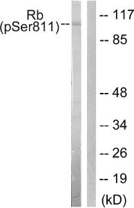 Western blot analysis of lysates from K562 cells using Anti-Retinoblastoma (phospho Ser811) Antibody. The right hand lane represents a negative control, where the antibody is blocked by the immunising peptide