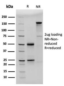 SDS-PAGE analysis of Anti-CD23 Antibody [FCER2/3592] under non-reduced and reduced conditions; showing intact IgG and intact heavy and light chains, respectively. SDS-PAGE analysis confirms the integrity and purity of the antibody