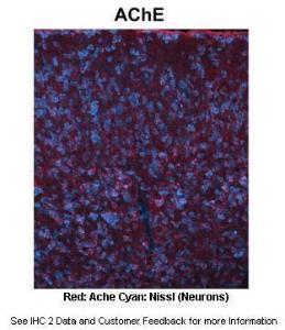 Anti-ACHE Rabbit Polyclonal Antibody