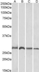 Anti-SIAH1 antibody