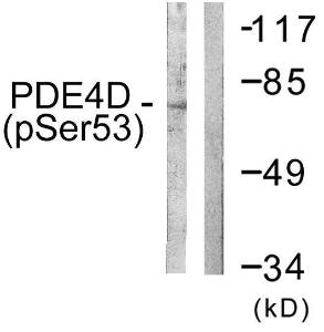 Western blot analysis of lysates from K562 cells treated with H2O2 100uM 30' using Anti-PDE4D (phospho Ser190 + Ser53) Antibody. The right hand lane represents a negative control, where the antibody is blocked by the immunising peptide