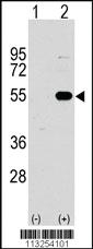 Anti-SPRED1 Rabbit Polyclonal Antibody