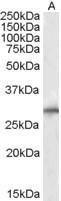 Anti-SIAH1 antibody