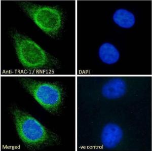 Anti-TRAC-1 Antibody (A121155) - Immunofluorescence analysis of paraformaldehyde fixed HeLa cells, permeabilized with 0.15% Triton. Primary incubation 1hr (10µg/ml) followed by Alexa Fluor 488 secondary antibody (2µg/ml), showing endoplasmic reticulum/Golgi and some nuclear staining.