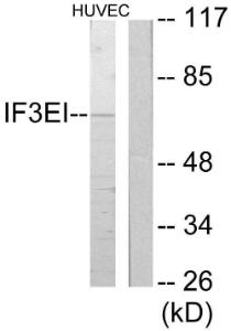 Anti-IF3EI antibody