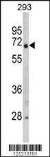 Anti-GNPAT Rabbit Polyclonal Antibody (AP (Alkaline Phosphatase))