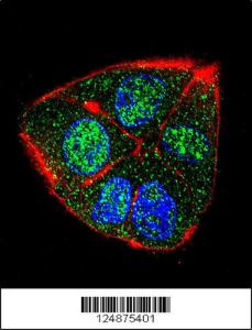 Anti-IFT88 Rabbit Polyclonal Antibody (PE (Phycoerythrin))