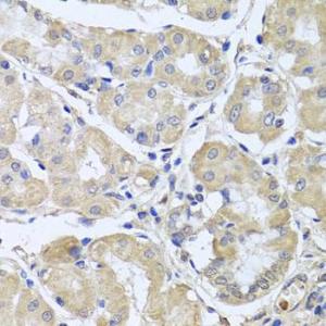 Immunohistochemistry of paraffin-embedded human stomach using Anti-CEP57L1 Antibody (A8290) at dilution of 1:100 (40x lens)