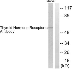 Western blot analysis of lysates from SKOV3 cells using Anti-Thyroid Hormone Receptor alpha Antibody. The right hand lane represents a negative control, where the antibody is blocked by the immunising peptide