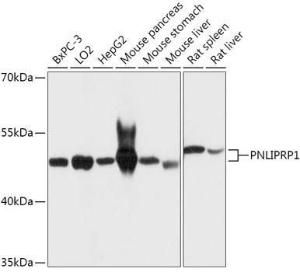 Anti-PNLIPRP1 antibody