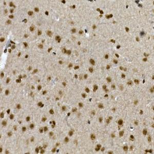 Immunohistochemistry analysis of paraffin-embedded mouse brain using Anti-ZNF213 Antibody (A308521) at a dilution of 1:100 (40x lens). Perform high pressure antigen retrieval with 10 mM citrate buffer pH 6.0 before commencing with IHC staining protocol.