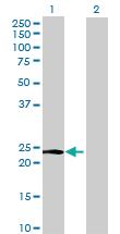 Anti-MFAP5 Mouse Polyclonal Antibody