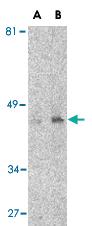 Anti-CD209 Mouse Monoclonal Antibody [clone: 8B6]