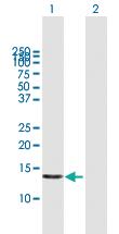 Anti-POLR1D Mouse Polyclonal Antibody