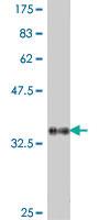 Anti-GTF3C4 Mouse Polyclonal Antibody