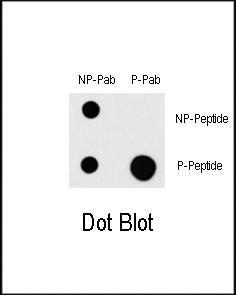 Anti-MAP3K1 Rabbit Polyclonal Antibody (FITC (Fluorescein Isothiocyanate))