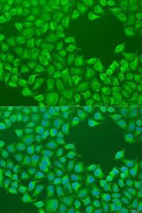 Immunofluorescence analysis of U2OS cells using Anti-CEP57L1 Antibody (A8290) at dilution of 1:100 Blue: DAPI for nuclear staining