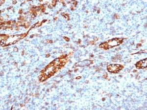 Immunohistochemical analysis of formalin-fixed, paraffin-embedded human tonsil tissue using Anti-CD31 Antibody [C31/6446R]