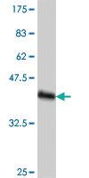 Anti-GTF3C3 Mouse Polyclonal Antibody