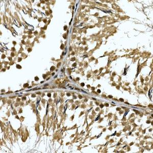 Immunohistochemistry analysis of paraffin-embedded rat testis using Anti-ZNF213 Antibody (A308521) at a dilution of 1:100 (40x lens). Perform high pressure antigen retrieval with 10 mM citrate buffer pH 6.0 before commencing with IHC staining protocol.