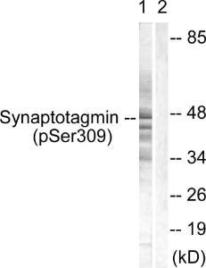 Anti-Synaptotagmin (phospho Ser309) Rabbit Polyclonal Antibody