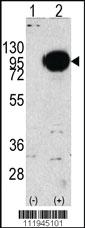 Anti-PYGM Rabbit Polyclonal Antibody