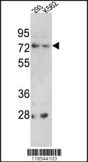 Anti-TNK2 Rabbit Polyclonal Antibody