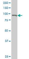 Anti-USP5 Mouse Polyclonal Antibody